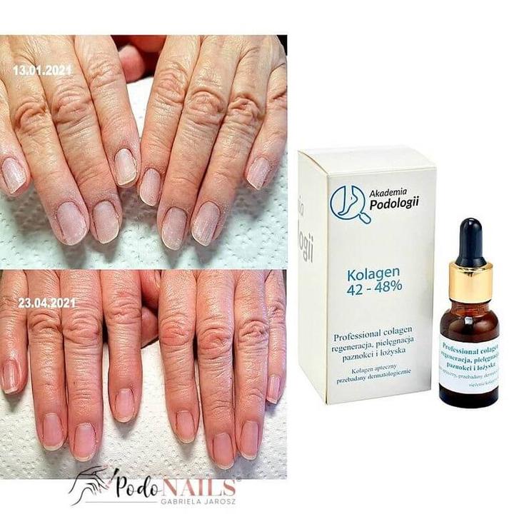 Czy płytka paznokcia ma zdolność do regeneracji? Oto, co warto wiedzieć