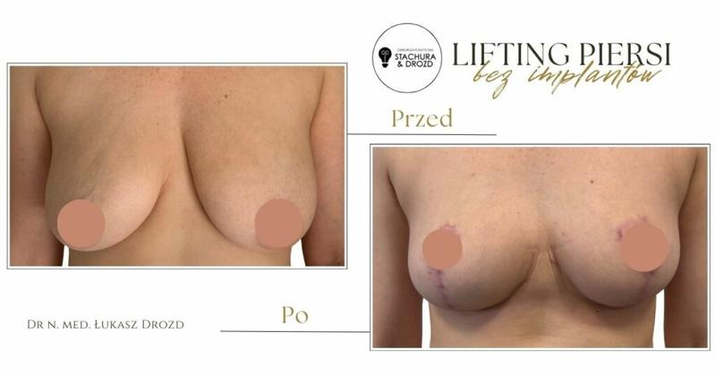 Preferencje mężczyzn a rozmiar biustu